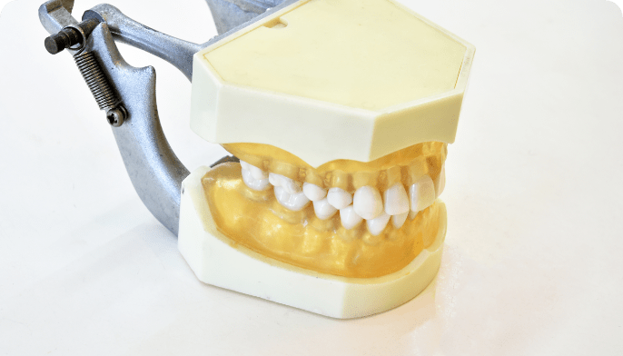 インプラント・入れ歯