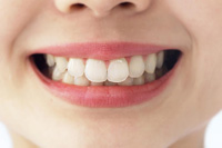歯周病は、歯を失う原因第1位